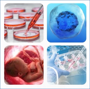 3 Stem cell